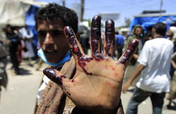 کشتار یمنی ها با سلاح عربستان