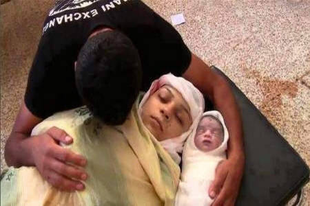 31شهید و 450 مجروح در غزه