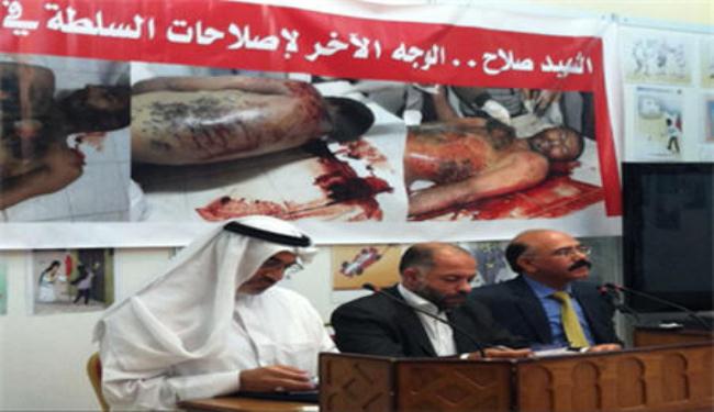 حقوقي: الامن البحريني عذب الشهيد عباس ومثل بجثته