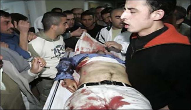 اصابة 7 فلسطينيين بجروح بينهم 4 اطفال بغارات للاحتلال