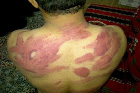 مرکز مبارزه با خشونت: شکنجه در بحرین ادامه دارد