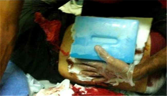 الامن البحريني يصيب مواطنا في بلدة كرانة