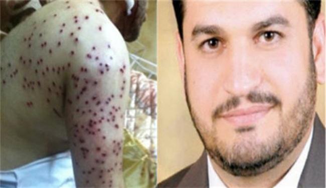 إصابة نائب بلدي بحريني، والإستئناف يتابع 3 قضايا بحق رجب