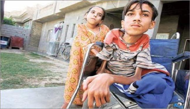 ارتفاع معدلات التشوهات الخلقية عند أطفال العراق