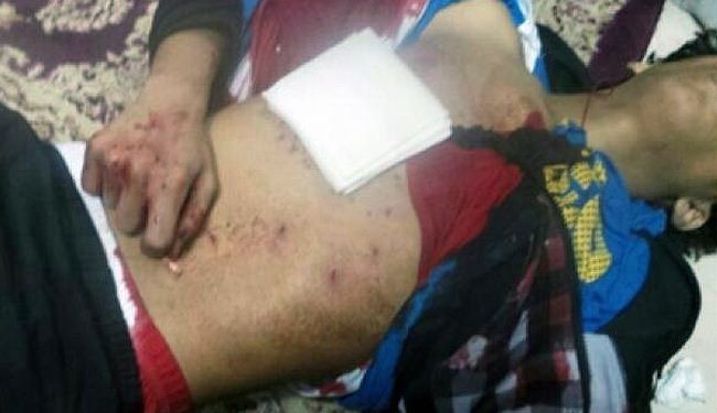استشهاد الطفل حسين الجزيري بأيدي الأمن البحريني