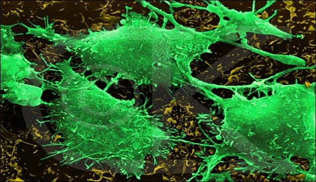الكشف عن بكتيريا مضادة للسرطان بتربة ايران