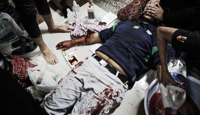 82 معتقلا و35 مصابا خلال اسبوع واحد بالبحرين