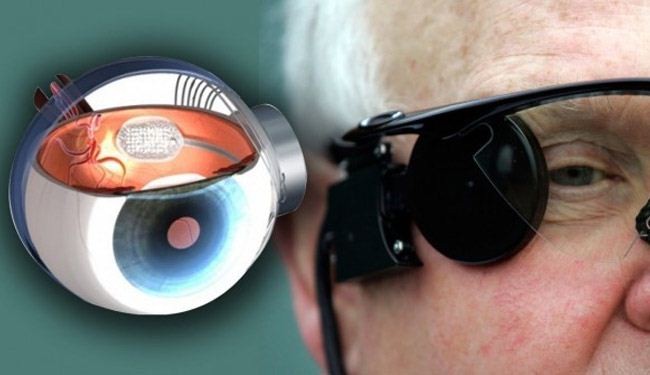 “العين الإلكترونية”: فرصة جديدة للمصابين بالعمى
