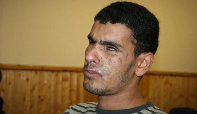 شکنجه جوان نابینای بحرینی در زندان