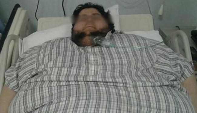 610kg Saudi man loses weight by half in 6 months