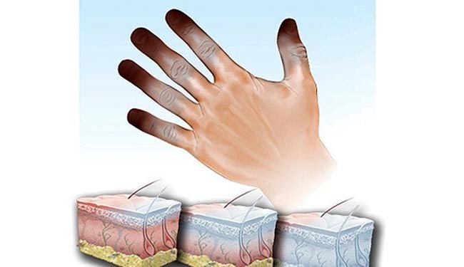 عالم روسي يتوصل الى طريقة للحفاظ على الأطراف المتجمدة