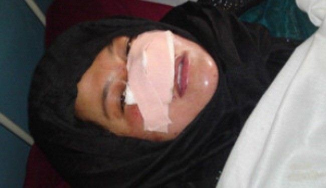 Afghan women cuts another woman’s nose off her face
