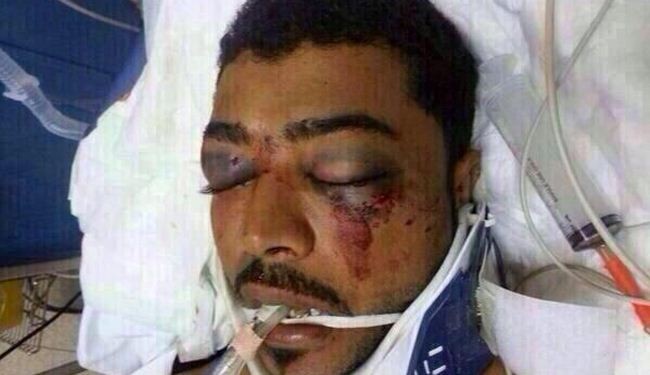 Human rights groups slam state brutality in Bahrain