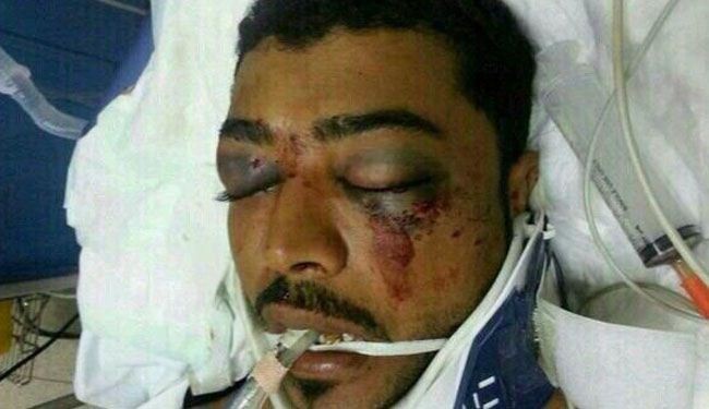 27 يوما على احتجاز نظام البحرين لجثة الشهيد العبار