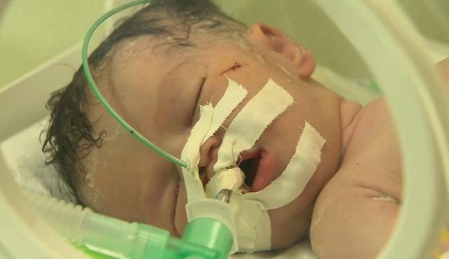 Gaza baby delivered after mother killed in Israeli airstrike