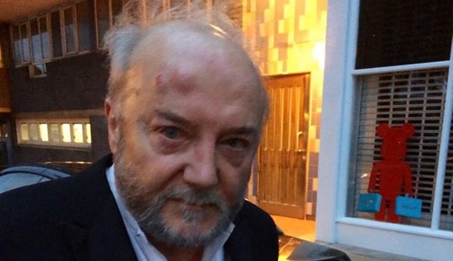 Pro-Palestine British MP injured by Zionist assailant