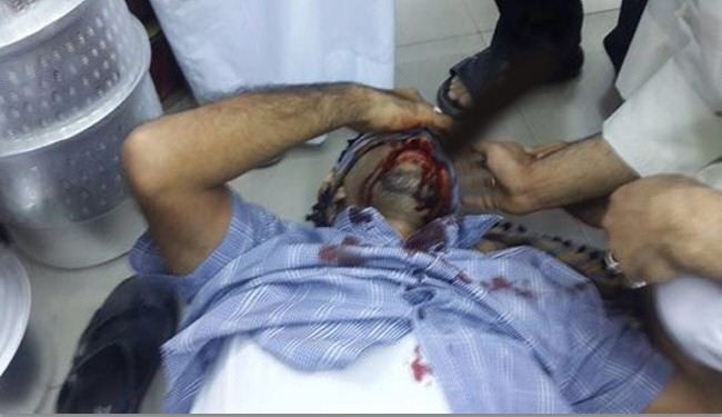الامن البحريني يوقف والد شهيد رغم إصابته البليغة