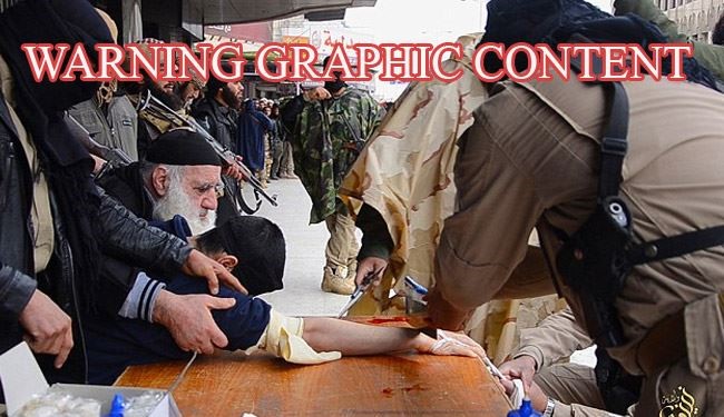 Sickening Photos Shows How ISIS Amputate Alleged 'Thief' Hands