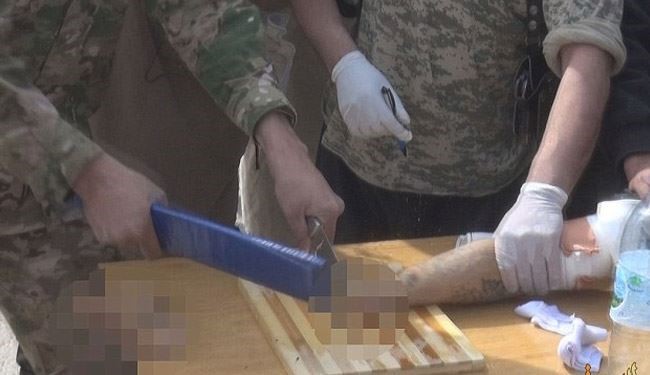 Another Horrific Images, Shows How ISIS Amputate Hand + Pics