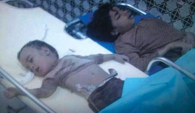 شيخ الاسلام: منع المساعدات الانسانية عن اليمنيين جريمة