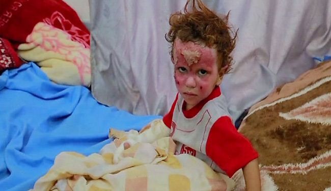 نساء واطفال ضحايا غارات سعودية بعدة مناطق في اليمن