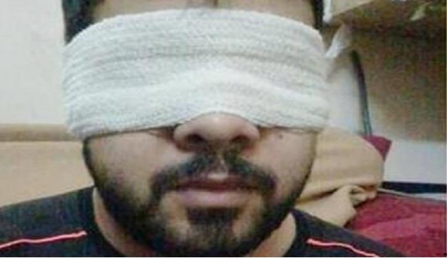زندانی بحرینی بینایی خود را از دست داد