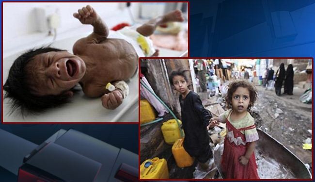 تحذير اممي من تجويع سعودي متعمد لاطفال اليمن