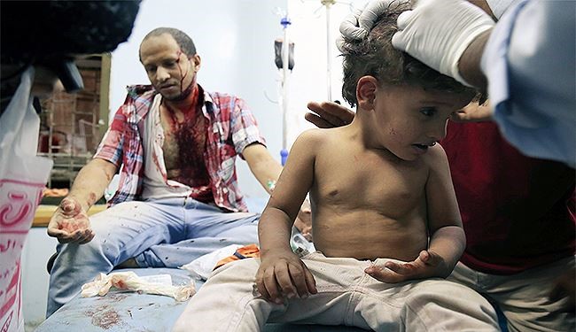 اكثر من مئة قتيل وجريح بالعدوان السعودي على اليمن