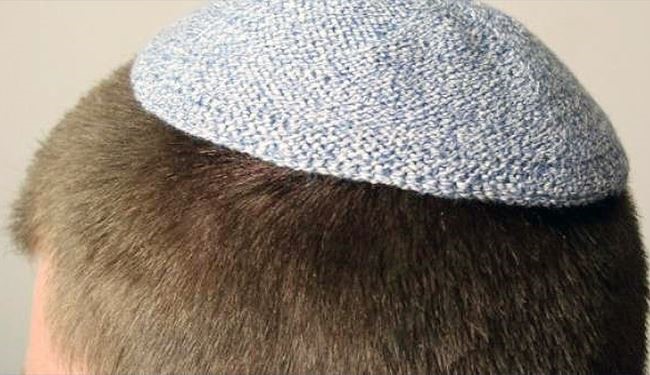 هل تعرف سبب وضع اليهود قبعة صغيرة على رؤوسهم!