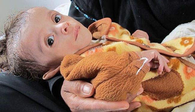 إنعدام الأمن الغذائي في اليمن خطوة ما قبل المجاعة