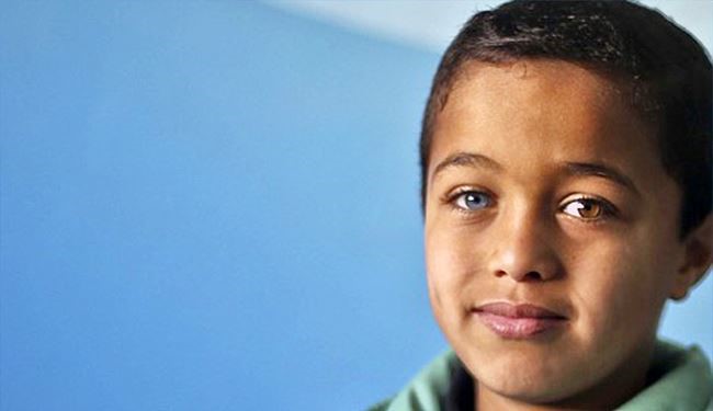 بالصور؛ طفل فلسطيني يتضايق من اختلاف لون عينيه