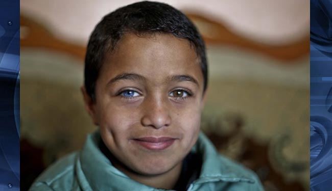 دردسر کودک فلسطینی به خاطر رنگ چشم ! + عکس