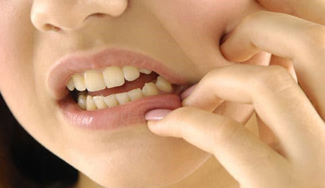 کشیدن دندان با هلی کوپتر+ عکس