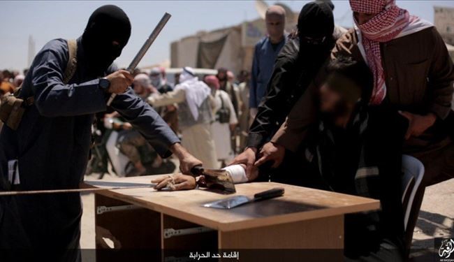 EXTREME GRAPHIC PICTURES: ISIS Cuts Hands & Legs of a Man in Raqqa
