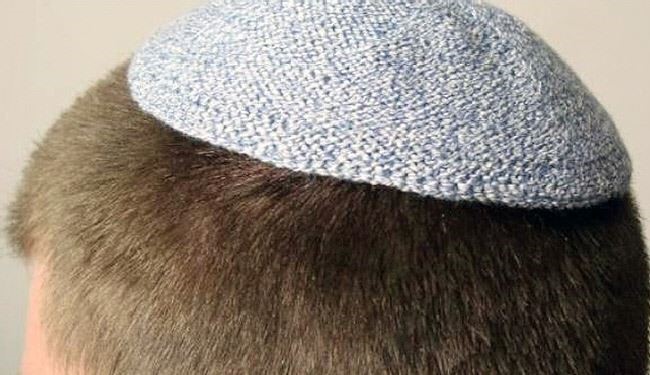 هل تعلم لماذا يرتدي اليهود قبعة صغيرة؟