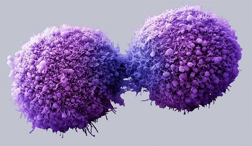 دراسة: خلايا سرطان الرئة تنتشر بحرية في الجسم