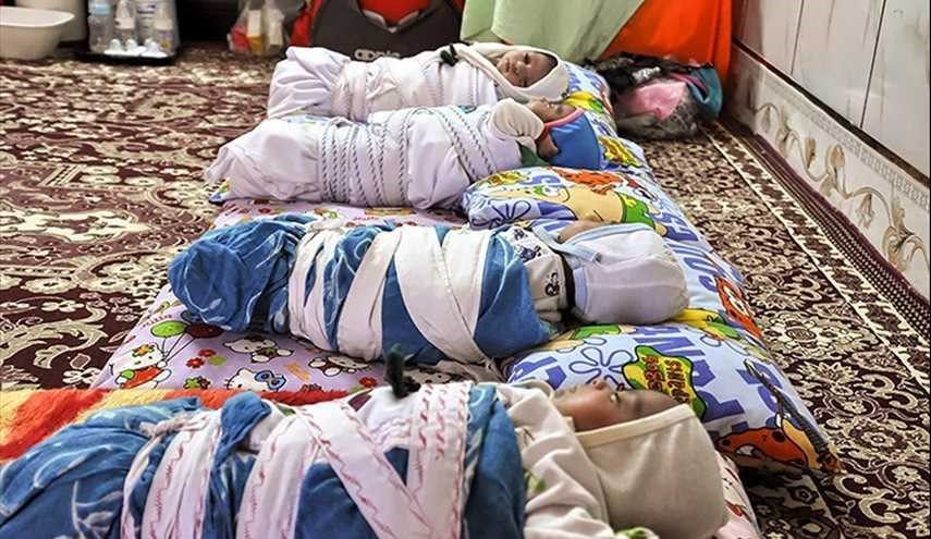 تولد چهارقلوها در سیستان و بلوچستان