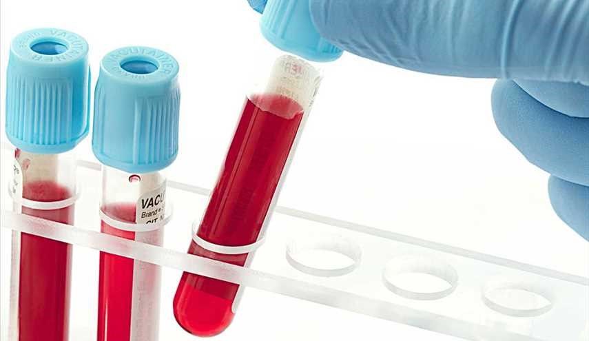 شناسایی بیش از 23 گروه خونی نادر در کشور
