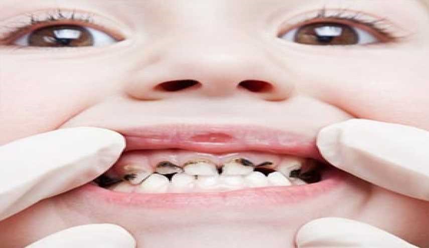 حساسیت‌ عاج دندانی چیست؟ علائم و توصیه‌ها