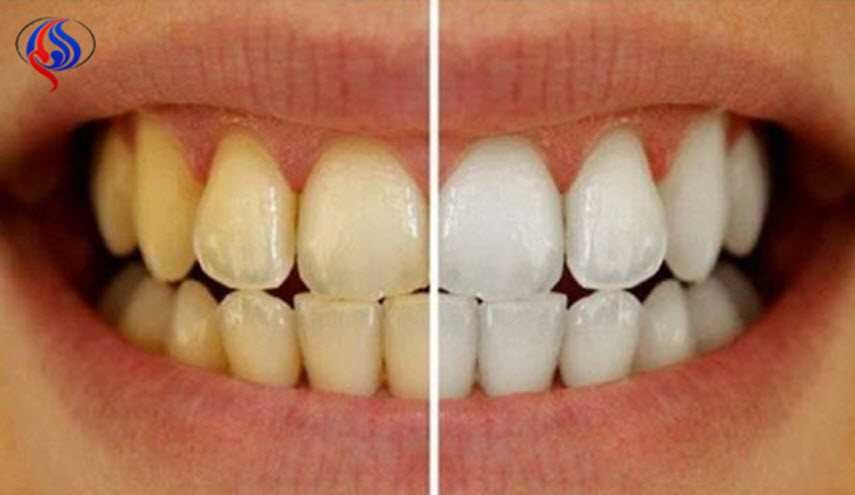 هذه هي الطرق الأمثل والأرخص لتبييض الاسنان