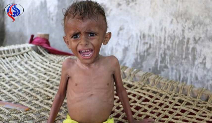 الأمم المتحدة تسعى لجمع أكثر من ملياري دولار لإنقاذ اليمن من المجاعة