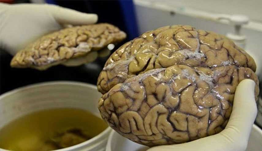 نگاهی به درون بزرگترین «بانک مغز» جهان