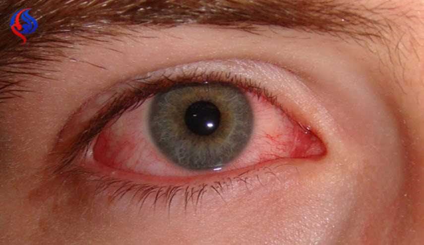 التحديق مطولا في الكمبيوتر هل يجهد العينين فقط ام يسبب العمى؟