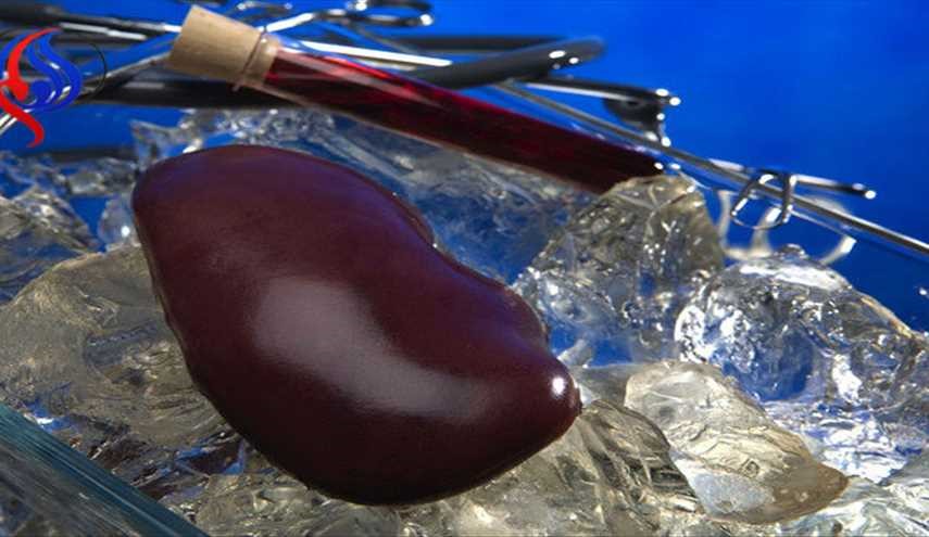 ابداع یک روش جدید برای نگهداری اندام‌های اهدایی