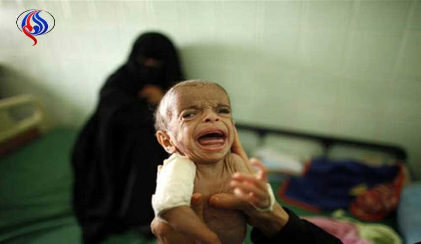 السعودية ومرتزقتها تقتل أطفال اليمن مرتين