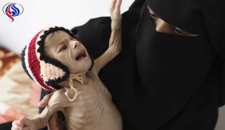 بحران گرسنگی و قحطی در یمن