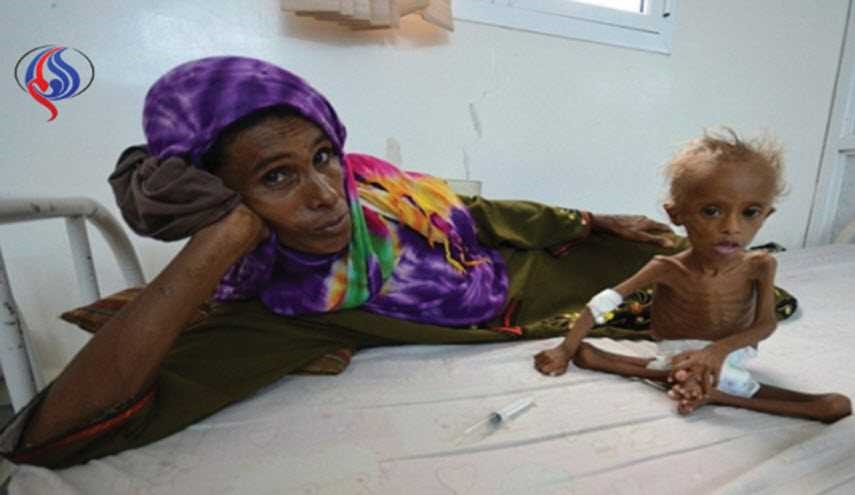 الصليب الأحمر يحذر من مجاعة محدقة باليمن والصومال