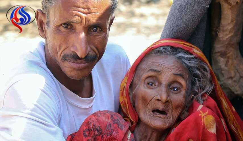 تازه ترین گزارش سازمان ملل از گرسنگی در یمن