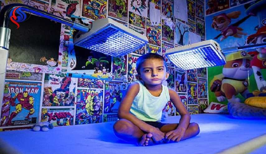 مرض نادر يجبر طفلا على البقاء تحت الضوء الأزرق + صور