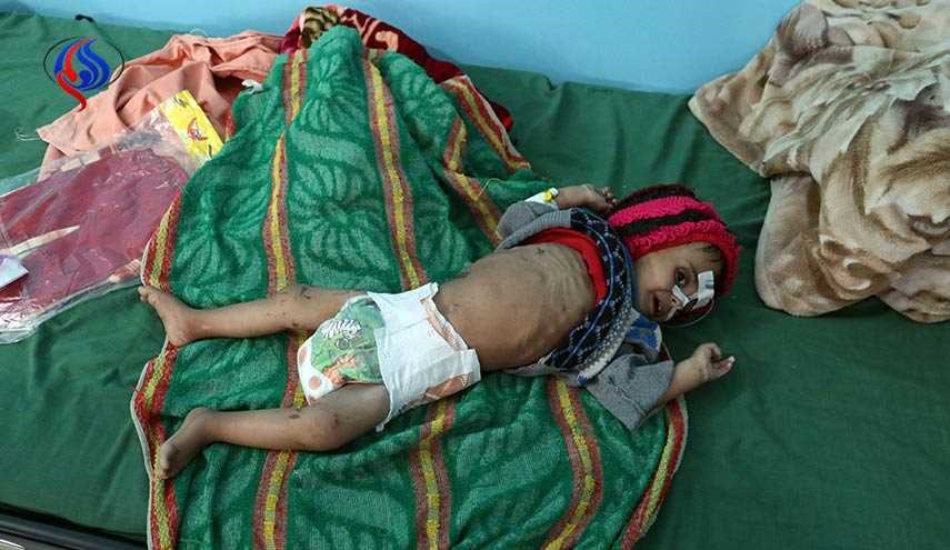 هل يعلم العرب ان كل عشر دقائق يموت طفل يمني؟